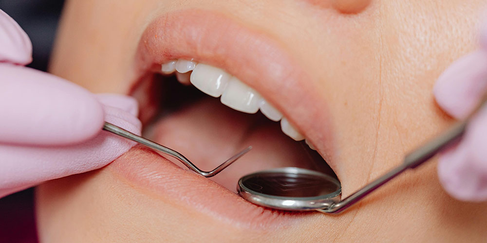 How Long Does a Teeth Cleaning Appointment Take?