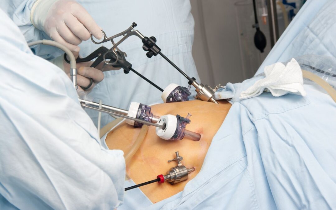 The Role of Psychology in Bariatric Success