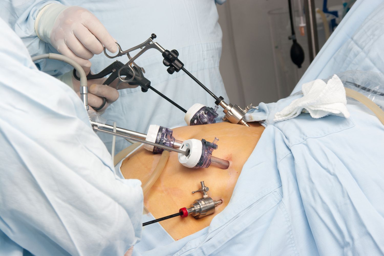 The Role of Psychology in Bariatric Success