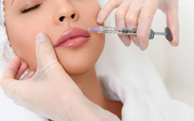 What Age Is Ideal for Lip Fillers ?