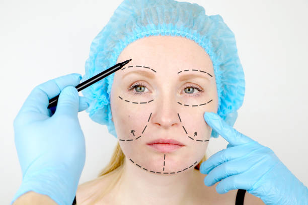 What Makes Facelift So Popular
