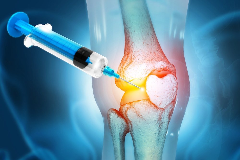Top Non-Surgical Options for Joint Pain Treatment