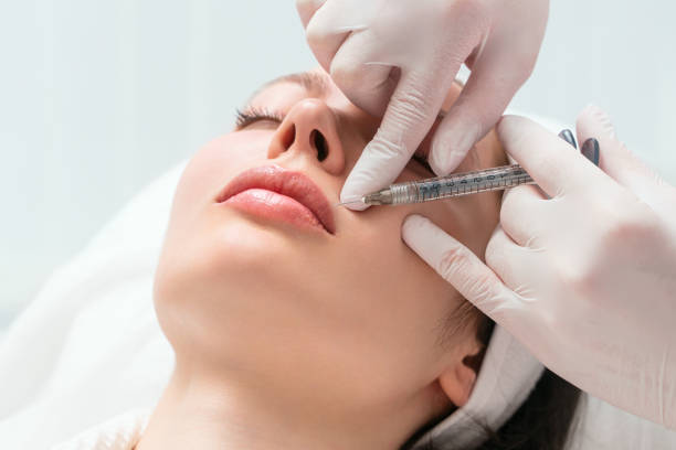 Are Russian Lip Fillers Suitable for Thin Lips