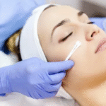  Chemical Peels