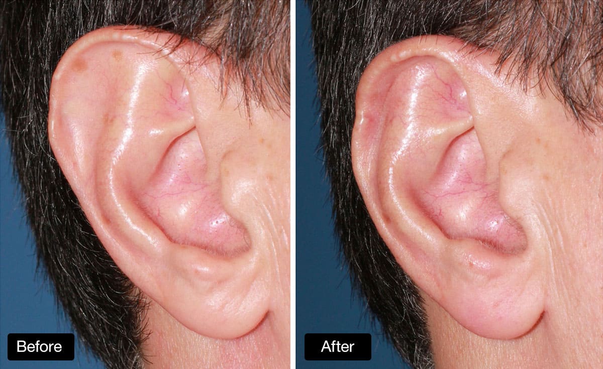 Create symmetrical ear shapes