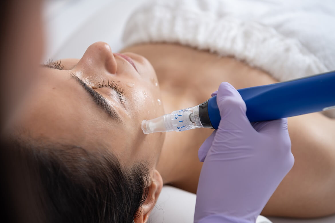 Dermapen for Under-Eye Rejuvenation Is It Safe & Effective