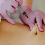 FAT DISSOLVING INJECTION