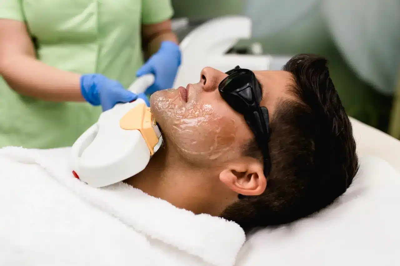 How Long Between Beard Laser Hair Removal Sessions