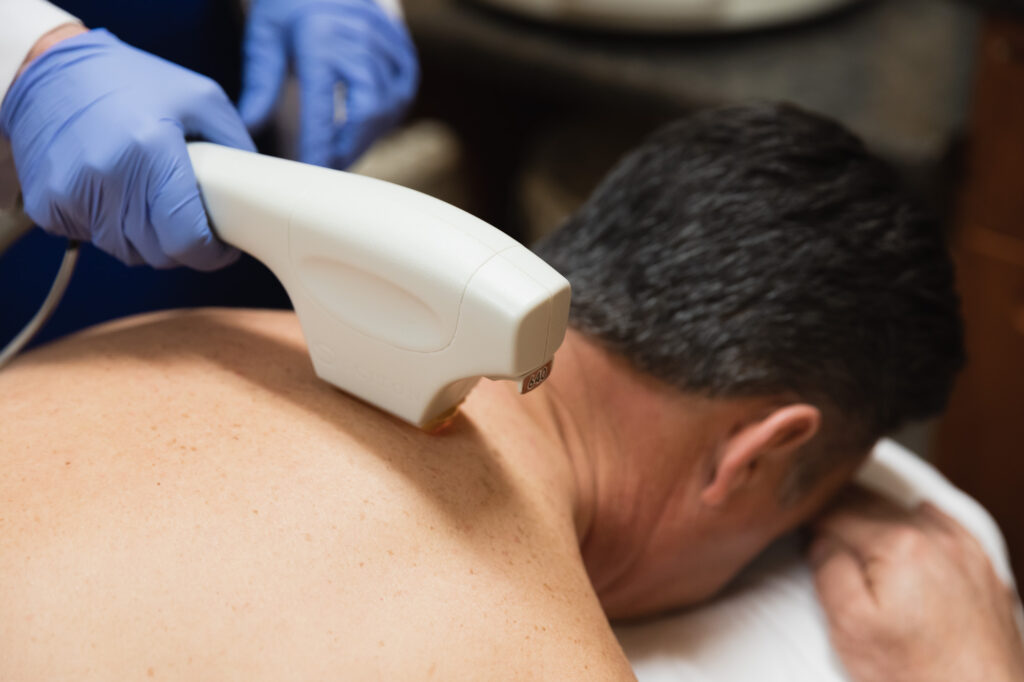 How Men’s Laser Hair Removal Saves Time and Effort