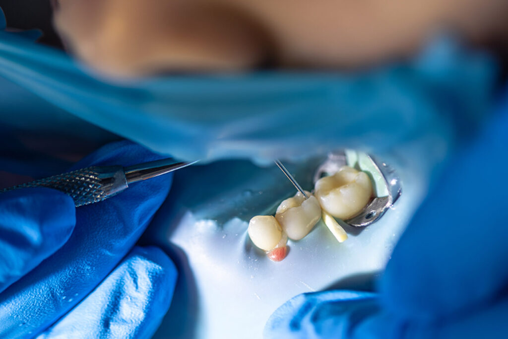 How Tooth Removal Can Improve Overall Oral Health