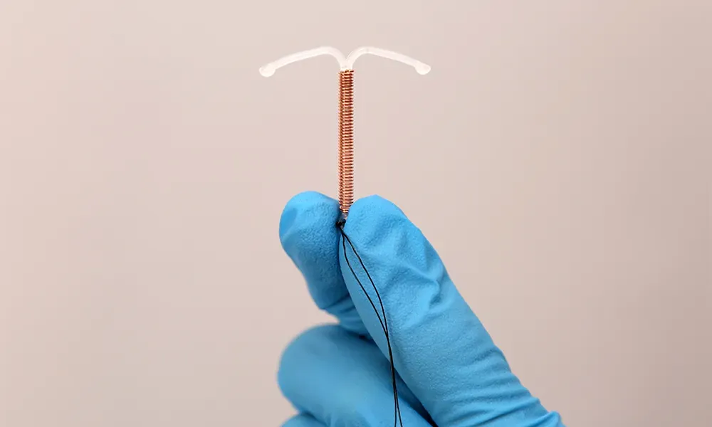 How to Prepare for Copper T  Insertion