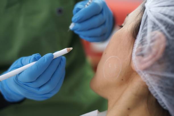 Is Botox Worth It for Anti-Aging Results