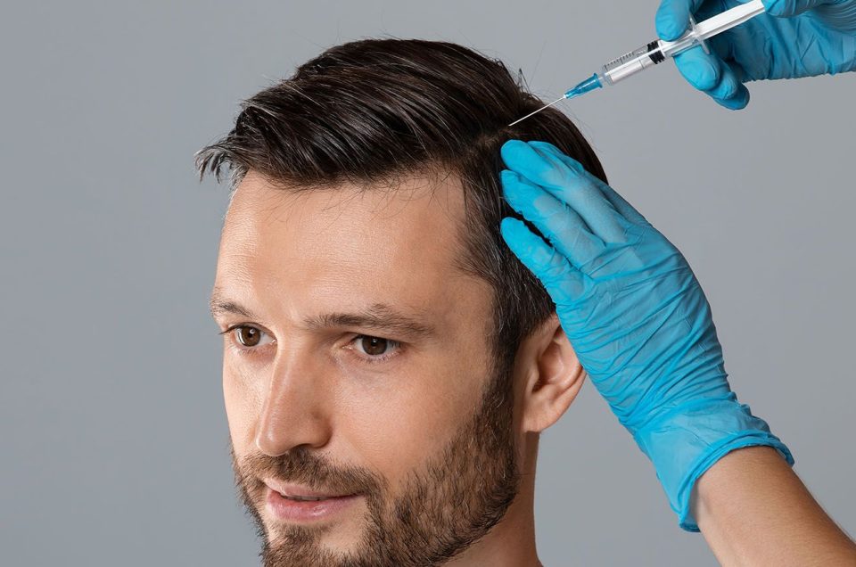 Is PRP Hair Treatment Suitable for Men
