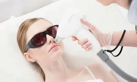 Laser Hair Removal in Dubai: Common Myths and Facts