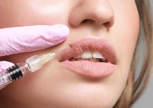 Lip Botox Enhance Lips Without Overdoing It