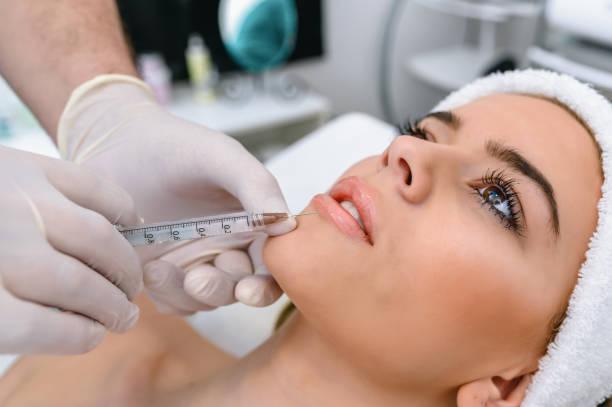 Lip Fillers Injections for Enhanced Smile