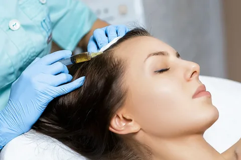 PRP Hair Treatment in Dubai: Your Path to Healthier Hair