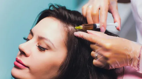 Frequently Asked Questions About PRP Hair Treatment in Dubai