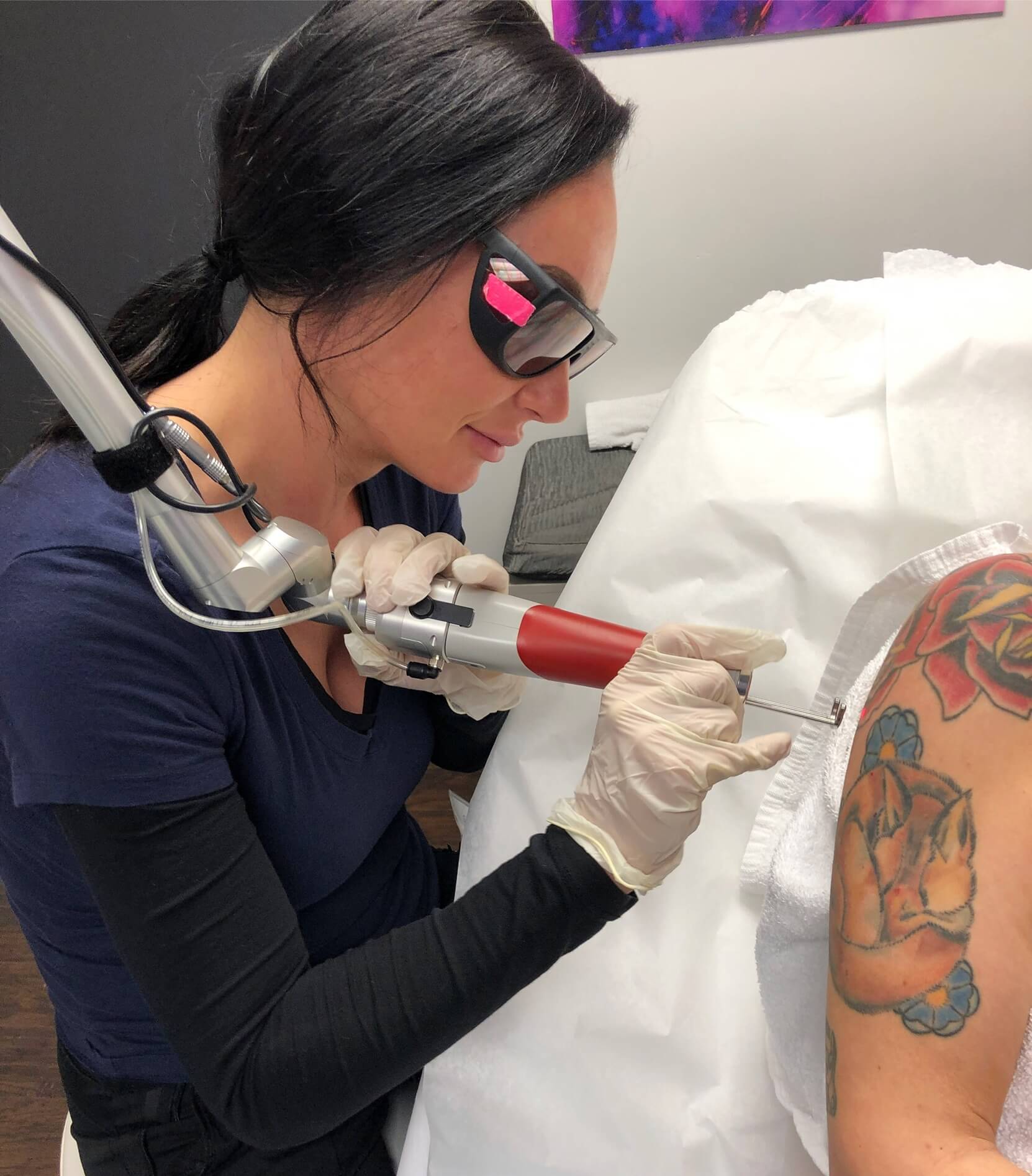 PicoSure Results for Colorful Tattoo Ink