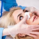  Rhinoplasty Surgery in Dubai