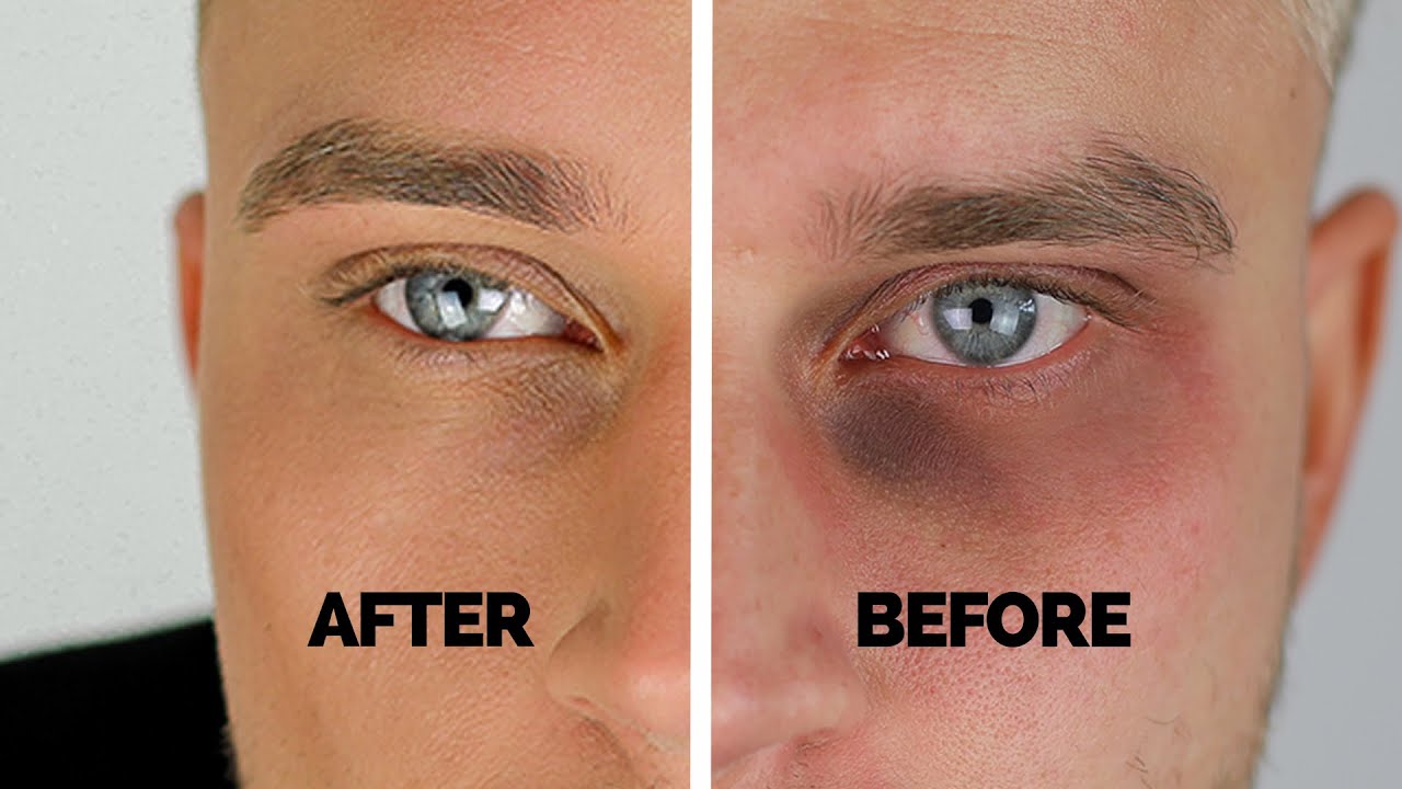 Reduce under-eye shadows