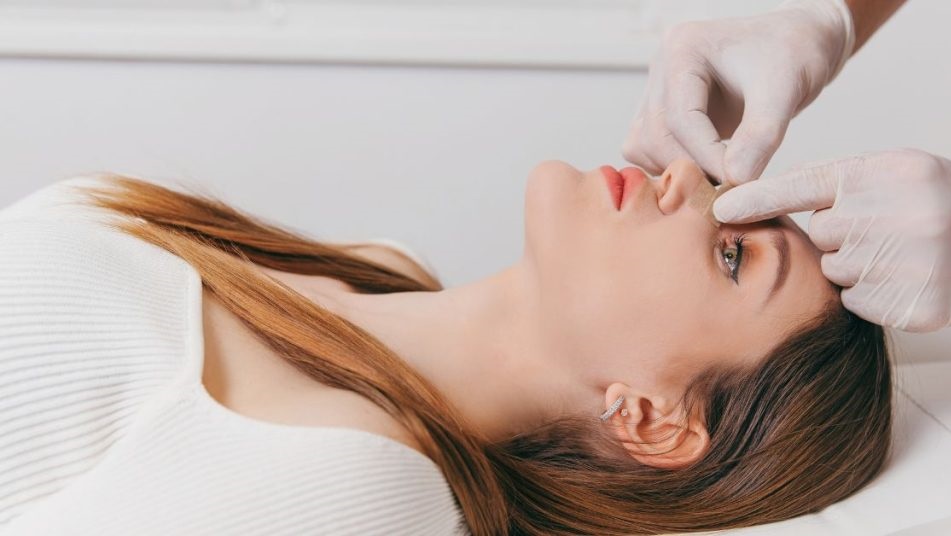 Rhinoplasty Precision Surgery for a Balanced Look