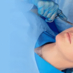 Rhinoplasty Surgery in Dubai 