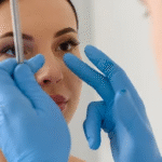Rhinoplasty surgery in Dubai