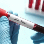 STD Test in Dubai