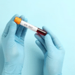 STD Test in Dubai