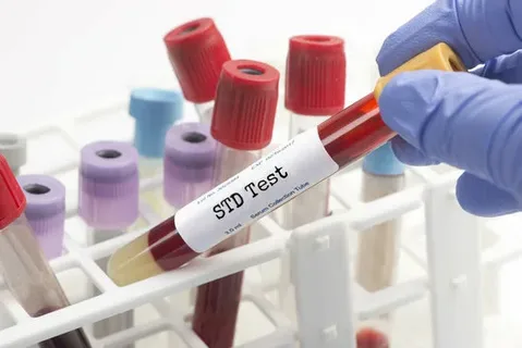 Understanding the Different Types of STD Tests in Dubai