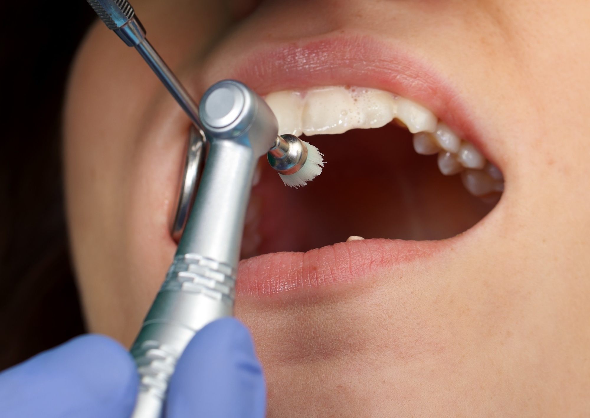 Teeth Cleaning Around the World Oral Hygiene in Global Cultures