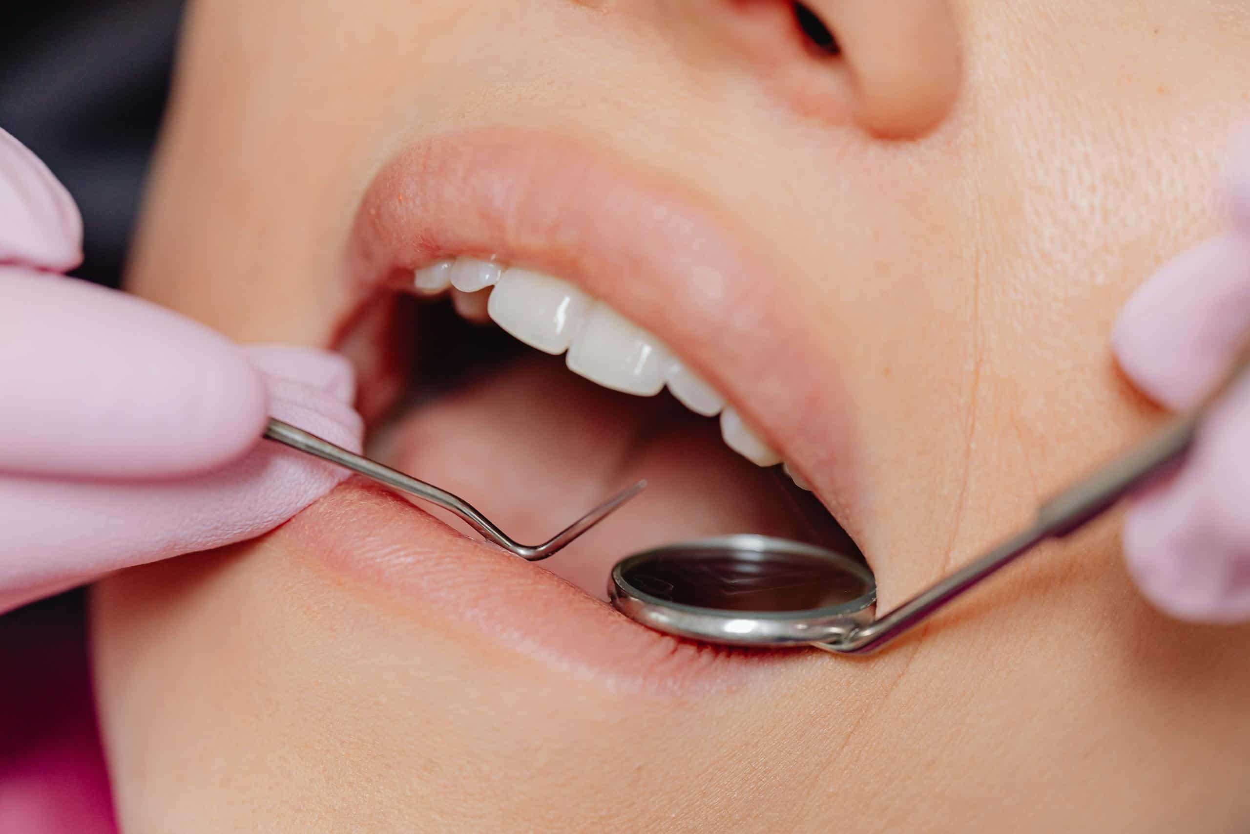 The Latest Advances in Tooth Removal Technology