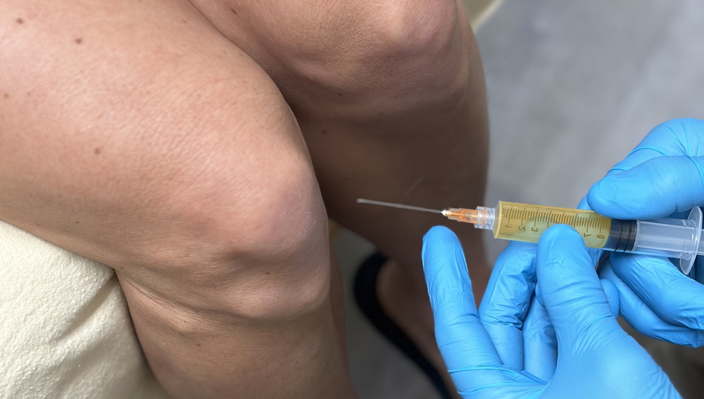 The Natural Healing Power of PRP for Knees