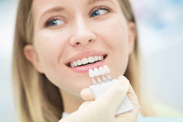 The Step-by-Step Process of Getting E-Max Veneers