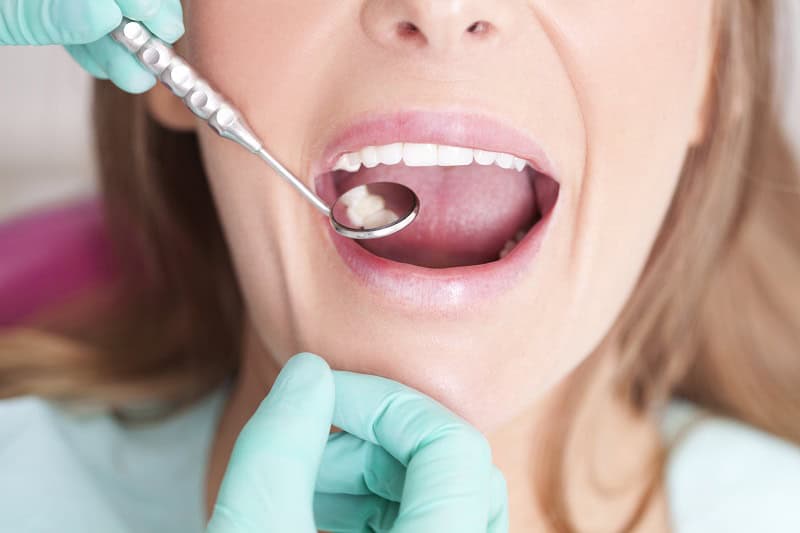 The Step by Step Process of Getting a Dental Tooth Filling