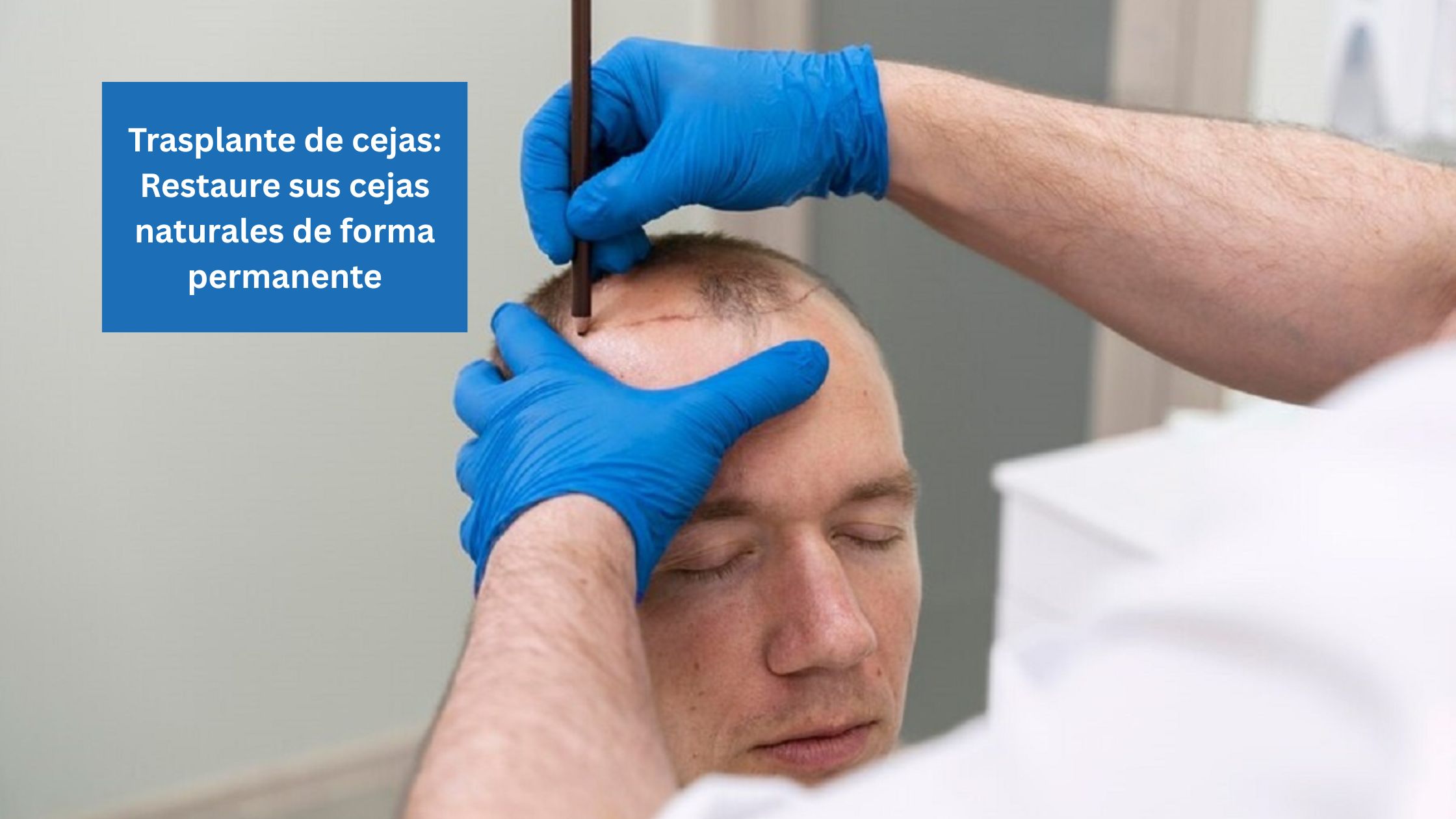 Trasplante de cejas Restaure sus cejas naturales de forma permanente