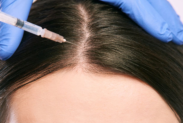 What Enfield Royal Clinic Offers for Hair Loss