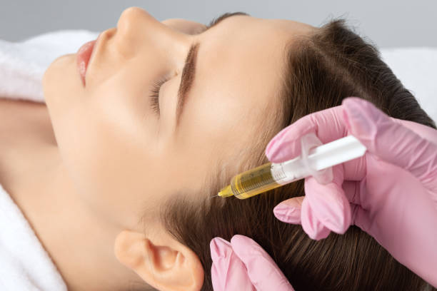 What Makes PRP Hair Treatment Popular?