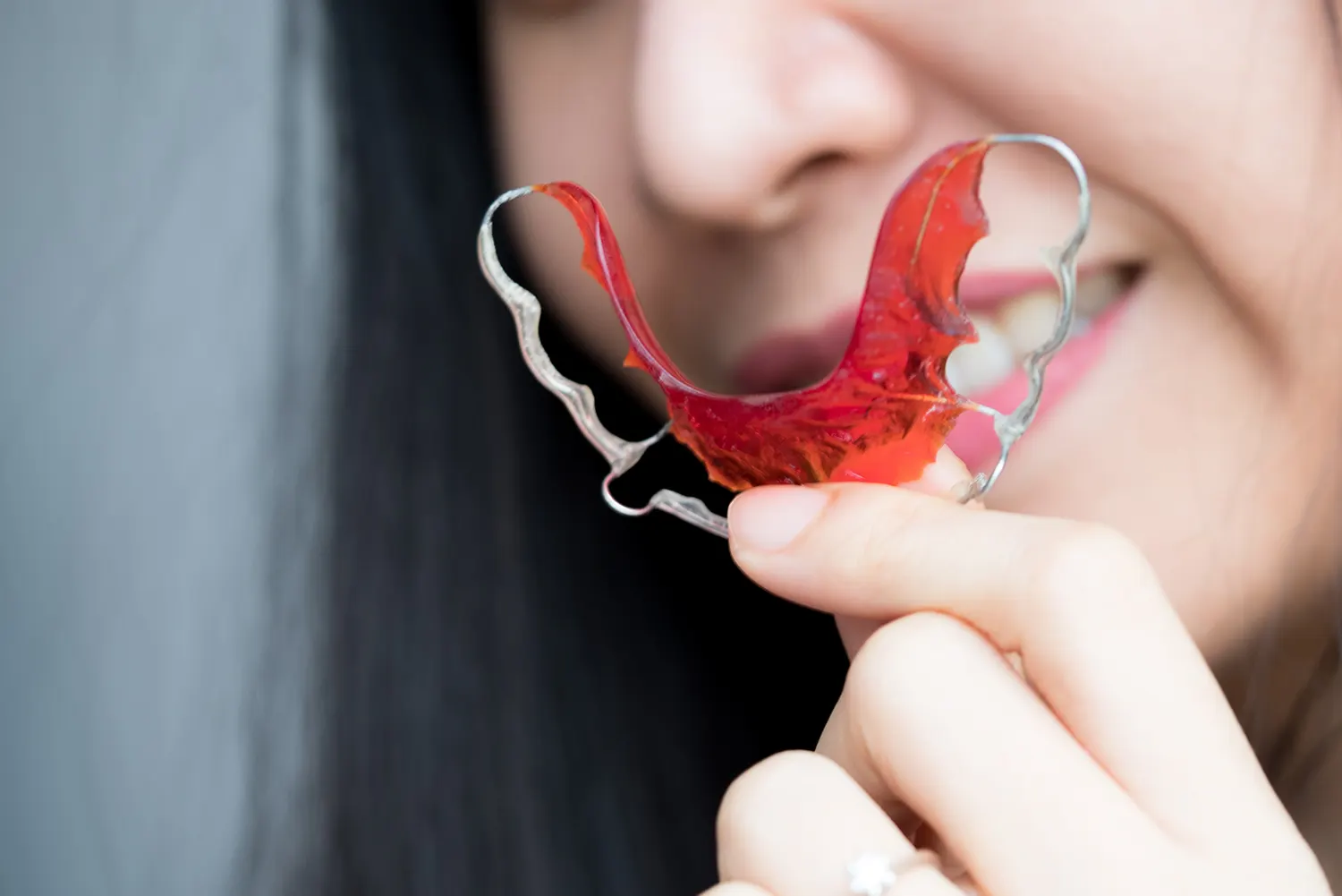 What to Do If Your Retainer Feels Too Tight
