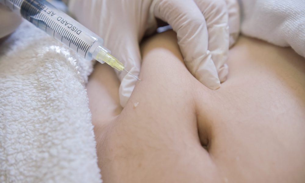 What to Know Before Fat Dissolving Injections