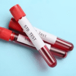 STD Test in Dubai