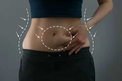 tummy truck surgery in dubai