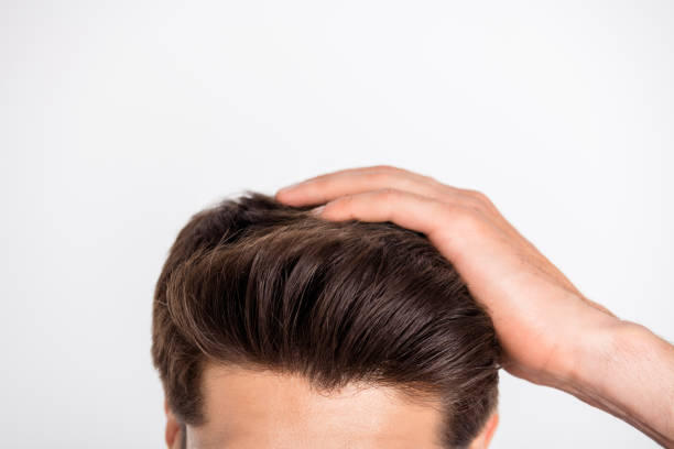 كم تدوم عملية زراعة الشعر ؟