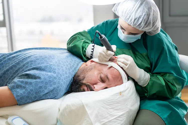 How to Sleep After a Hair Transplant Procedure?
