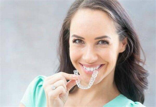 Aligners for Gap Teeth How Effective Are They