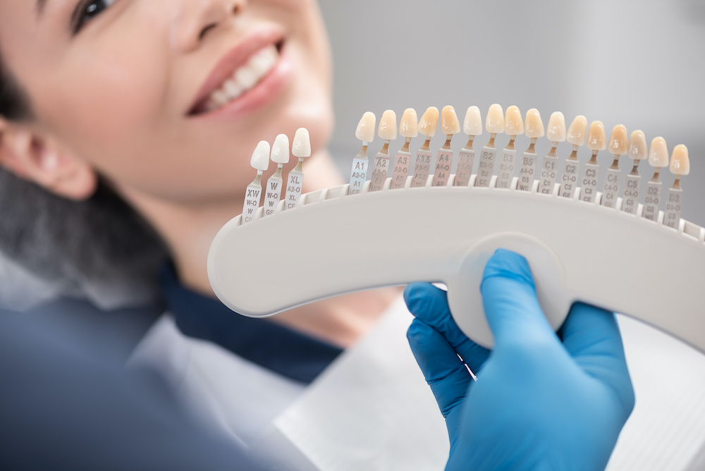 Are Composite Veneers Reversible Dentist Answers