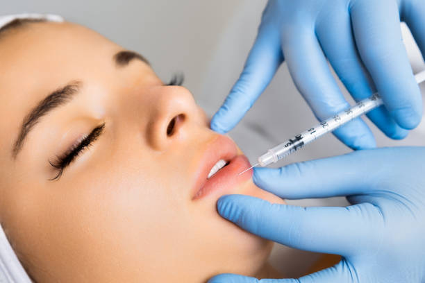 Botox Lipflip in Riyadh