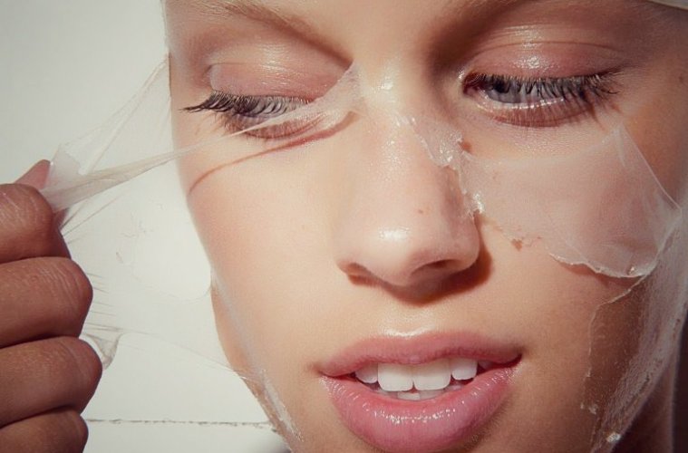 Can Chemical Peel Treat Hyperpigmentation Issues?