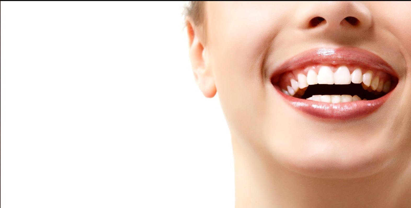 Can Composite Bonding Fix Chipped and Broken Teeth